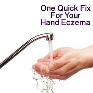 Discover One Common Cause for Hand Eczema + 7 Easy Tips To Heal It
