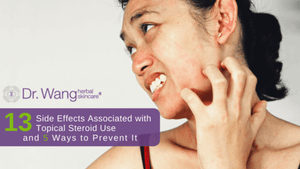 Top 13 Side Effects Associated With Topical Steroid Use + 5 Ways to Prevent It