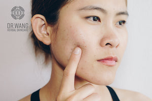 Top 6 Ways to Avoid Breakouts