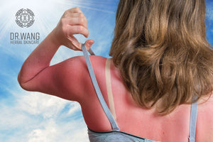Why Does my Skin Itch in the Sun?
