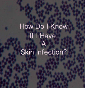 How Do You Know If You Have A Skin Infection?